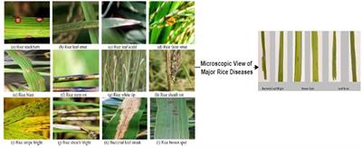 A systematic review of deep learning applications for rice disease diagnosis: current trends and future directions